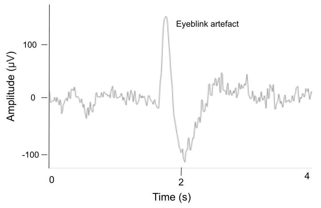 Eyeblink artefact in raw EEG